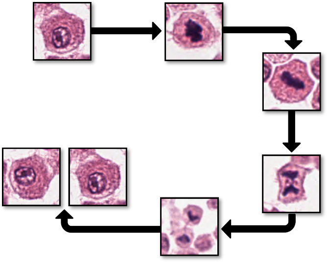 A tumor cell (upper left image image) can divide into two daughter cells (lower left images) through a structured process called mitosis. These dividing cells can be detected in histological images as mitotic figures comprising various morphological phases (four images on the right).